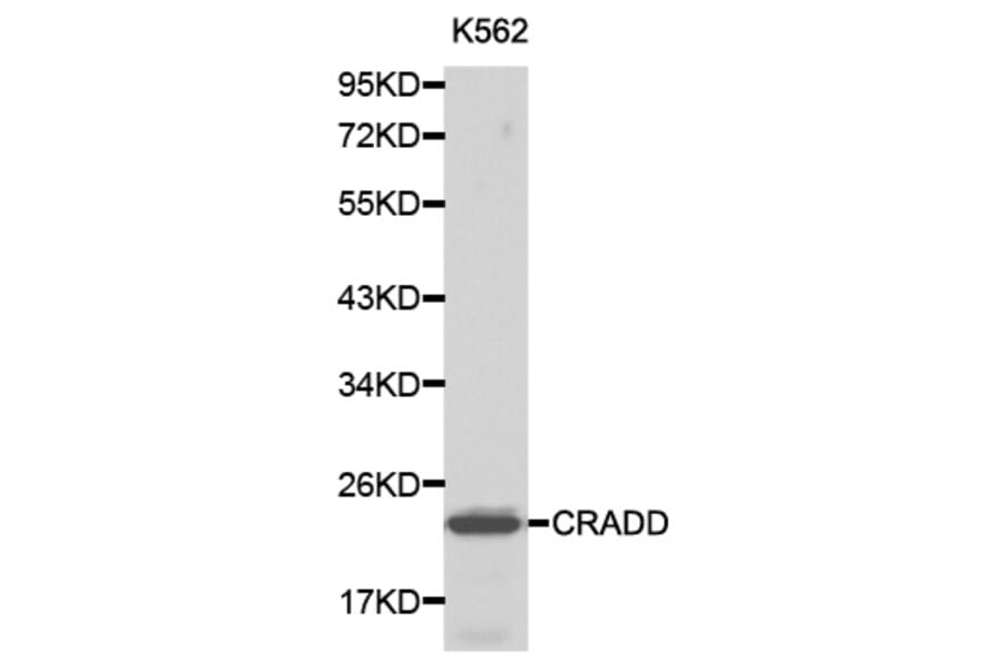 Western blot - CRADD antibody from Signalway Antibody (38194) - Antibodies.com