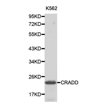 Western blot - CRADD antibody from Signalway Antibody (38194) - Antibodies.com