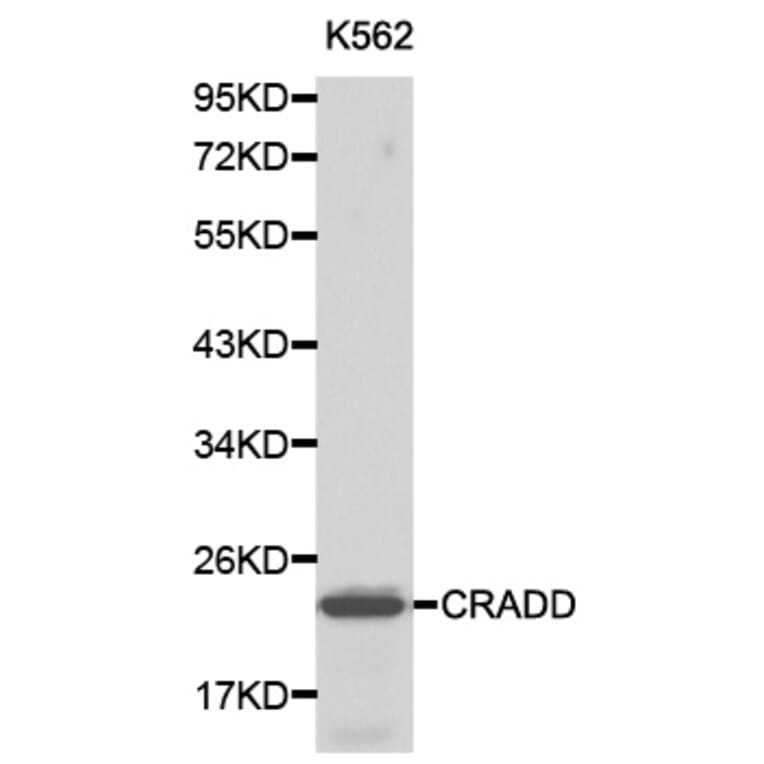 Western blot - CRADD antibody from Signalway Antibody (38194) - Antibodies.com