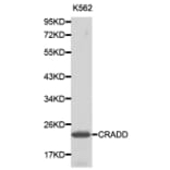 Western blot - CRADD antibody from Signalway Antibody (38194) - Antibodies.com