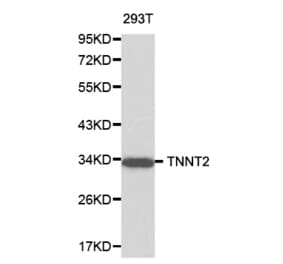 Western blot - TNNT2 antibody from Signalway Antibody (38195) - Antibodies.com