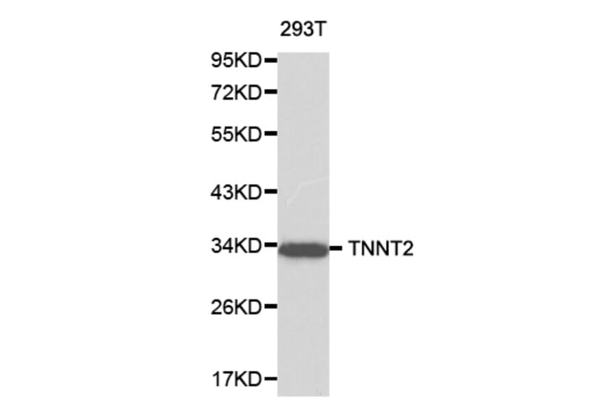 Western blot - TNNT2 antibody from Signalway Antibody (38195) - Antibodies.com