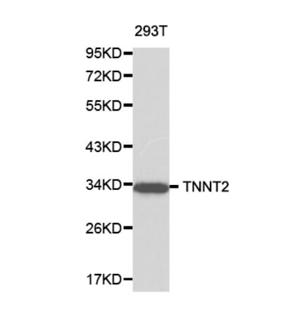 Western blot - TNNT2 antibody from Signalway Antibody (38195) - Antibodies.com