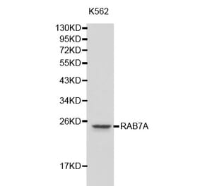 Western blot - RAB7A antibody from Signalway Antibody (38205) - Antibodies.com
