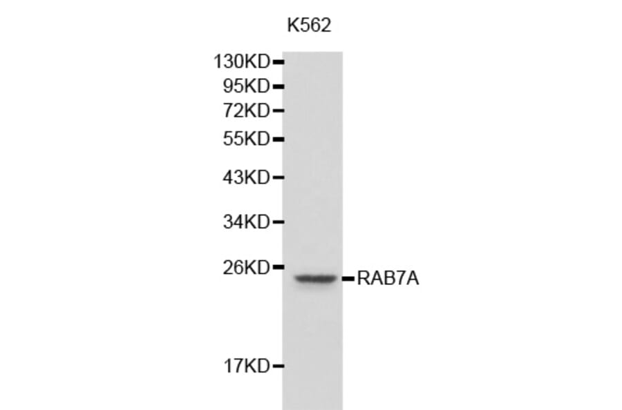 Western blot - RAB7A antibody from Signalway Antibody (38205) - Antibodies.com