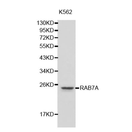 Western blot - RAB7A antibody from Signalway Antibody (38205) - Antibodies.com