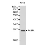 Western blot - RAB7A antibody from Signalway Antibody (38205) - Antibodies.com