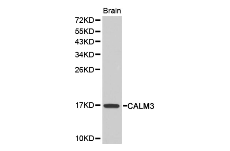 Western blot - CALM3 antibody from Signalway Antibody (38207) - Antibodies.com