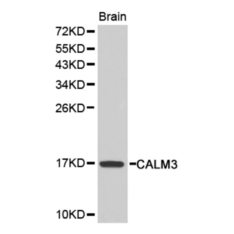 Western blot - CALM3 antibody from Signalway Antibody (38207) - Antibodies.com