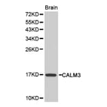 Western blot - CALM3 antibody from Signalway Antibody (38207) - Antibodies.com