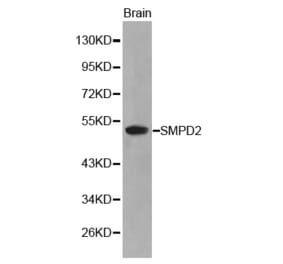 Western blot - SMPD2 antibody from Signalway Antibody (38208) - Antibodies.com