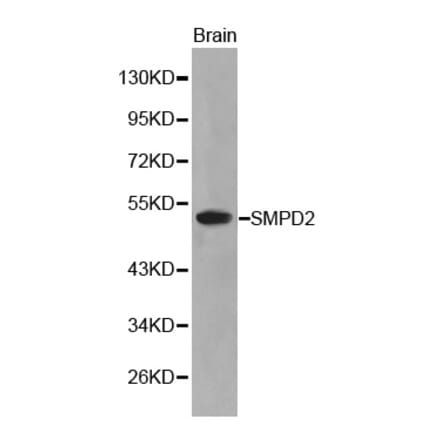 Western blot - SMPD2 antibody from Signalway Antibody (38208) - Antibodies.com