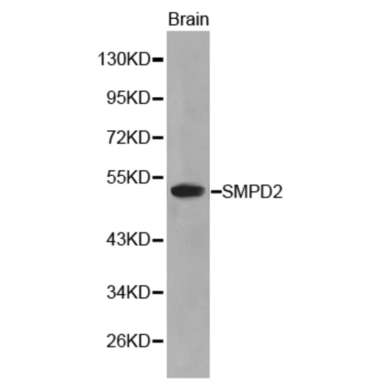 Western blot - SMPD2 antibody from Signalway Antibody (38208) - Antibodies.com
