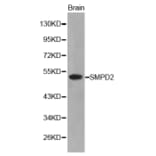 Western blot - SMPD2 antibody from Signalway Antibody (38208) - Antibodies.com