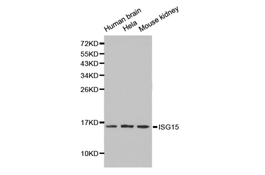 Western blot - ISG15 antibody from Signalway Antibody (38211) - Antibodies.com