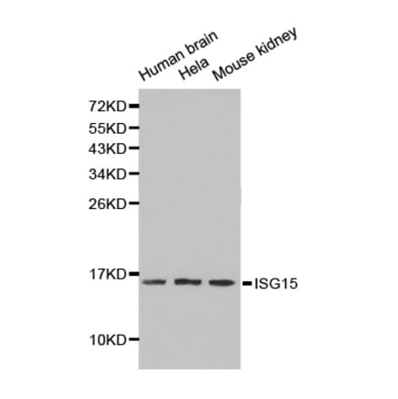 Western blot - ISG15 antibody from Signalway Antibody (38211) - Antibodies.com