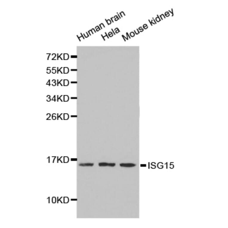 Western blot - ISG15 antibody from Signalway Antibody (38211) - Antibodies.com