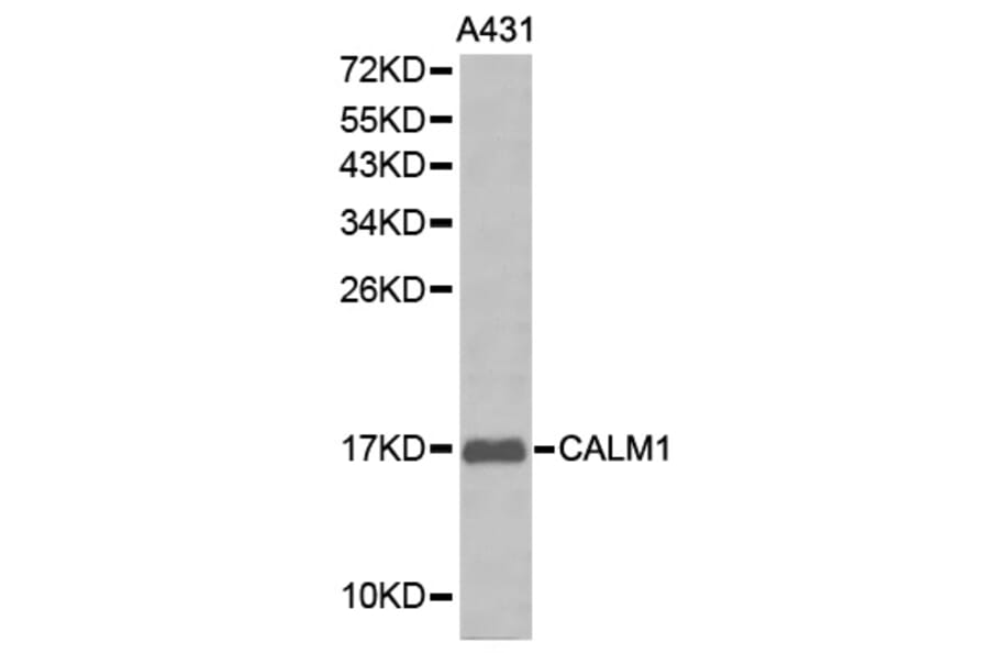 Western blot - CALM1 antibody from Signalway Antibody (38212) - Antibodies.com