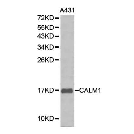 Western blot - CALM1 antibody from Signalway Antibody (38212) - Antibodies.com
