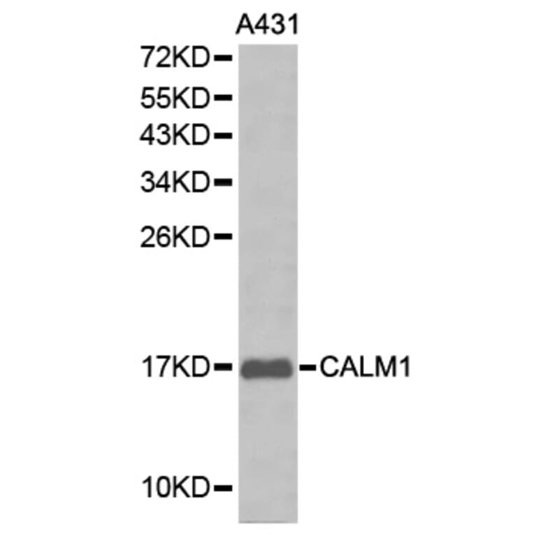 Western blot - CALM1 antibody from Signalway Antibody (38212) - Antibodies.com