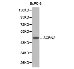 Western blot - SCRN2 antibody from Signalway Antibody (38215) - Antibodies.com