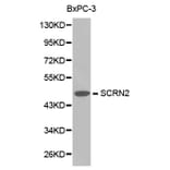 Western blot - SCRN2 antibody from Signalway Antibody (38215) - Antibodies.com