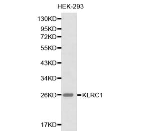 Western blot - KLRC1 antibody from Signalway Antibody (38222) - Antibodies.com