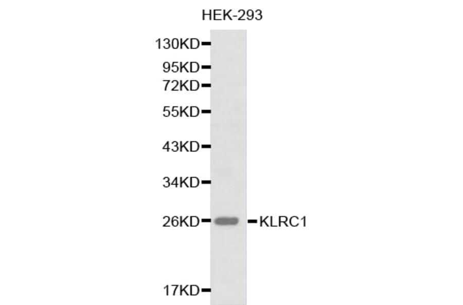 Western blot - KLRC1 antibody from Signalway Antibody (38222) - Antibodies.com