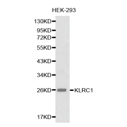 Western blot - KLRC1 antibody from Signalway Antibody (38222) - Antibodies.com