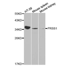 Western blot - PRSS1 antibody from Signalway Antibody (38226) - Antibodies.com