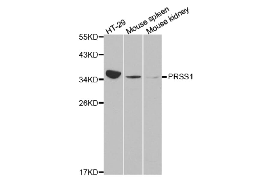 Western blot - PRSS1 antibody from Signalway Antibody (38226) - Antibodies.com