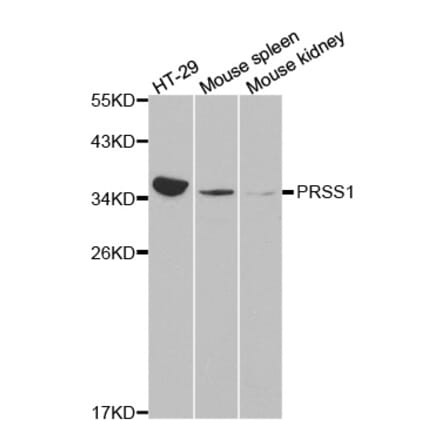 Western blot - PRSS1 antibody from Signalway Antibody (38226) - Antibodies.com
