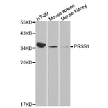Western blot - PRSS1 antibody from Signalway Antibody (38226) - Antibodies.com