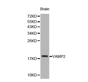 Western blot - VAMP2 antibody from Signalway Antibody (38228) - Antibodies.com