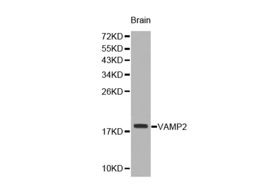 Western blot - VAMP2 antibody from Signalway Antibody (38228) - Antibodies.com
