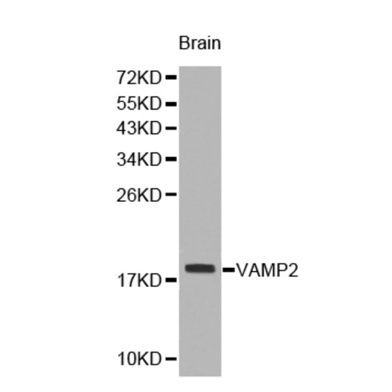 Western blot - VAMP2 antibody from Signalway Antibody (38228) - Antibodies.com