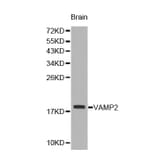 Western blot - VAMP2 antibody from Signalway Antibody (38228) - Antibodies.com