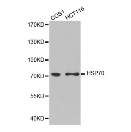 Western blot - HSP70 antibody from Signalway Antibody (38244) - Antibodies.com