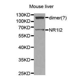 Western blot - NR1I2 antibody from Signalway Antibody (38259) - Antibodies.com