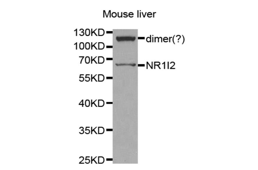Western blot - NR1I2 antibody from Signalway Antibody (38259) - Antibodies.com