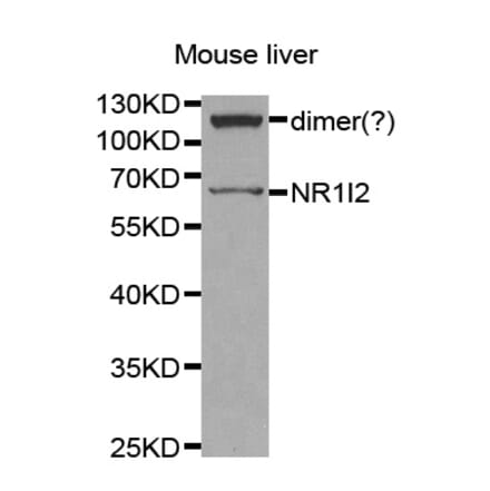 Western blot - NR1I2 antibody from Signalway Antibody (38259) - Antibodies.com