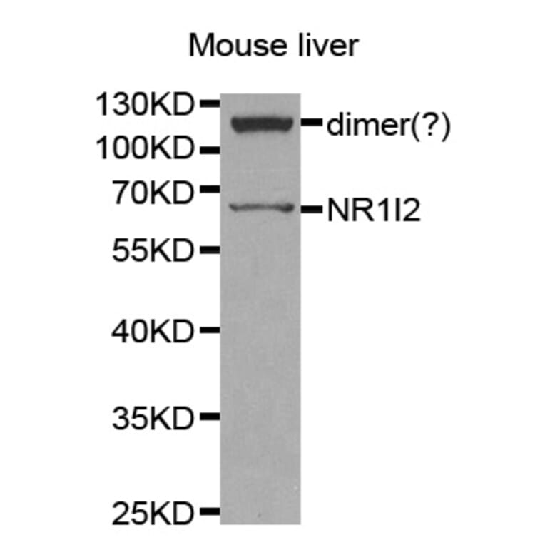 Western blot - NR1I2 antibody from Signalway Antibody (38259) - Antibodies.com