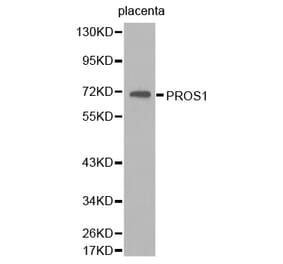 Western blot - PROS1 antibody from Signalway Antibody (38263) - Antibodies.com