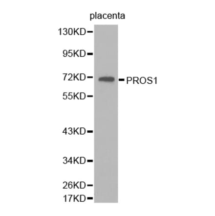 Western blot - PROS1 antibody from Signalway Antibody (38263) - Antibodies.com