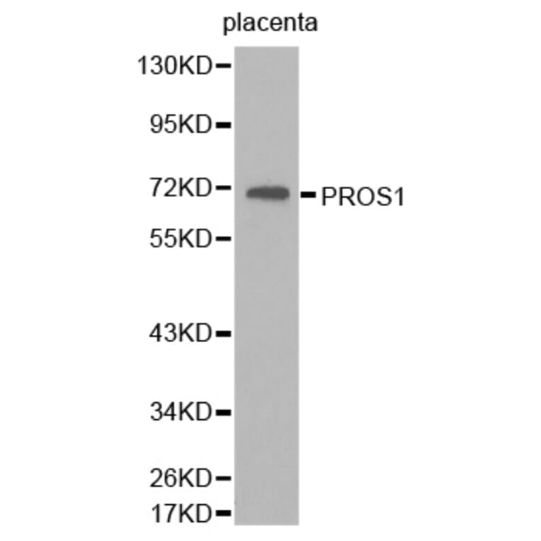 Western blot - PROS1 antibody from Signalway Antibody (38263) - Antibodies.com