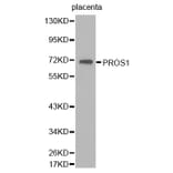 Western blot - PROS1 antibody from Signalway Antibody (38263) - Antibodies.com