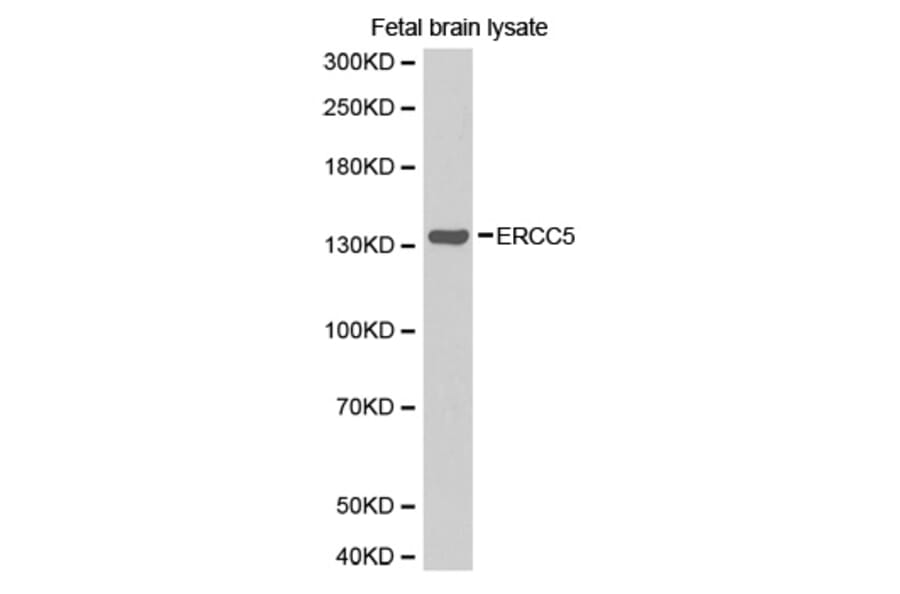 Western blot - ERCC5 antibody from Signalway Antibody (38266) - Antibodies.com