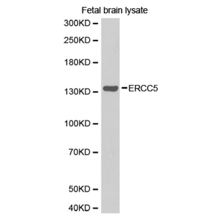 Western blot - ERCC5 antibody from Signalway Antibody (38266) - Antibodies.com