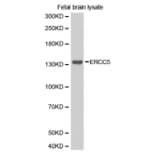Western blot - ERCC5 antibody from Signalway Antibody (38266) - Antibodies.com