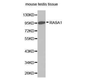 Western blot - RASA1 antibody from Signalway Antibody (38272) - Antibodies.com